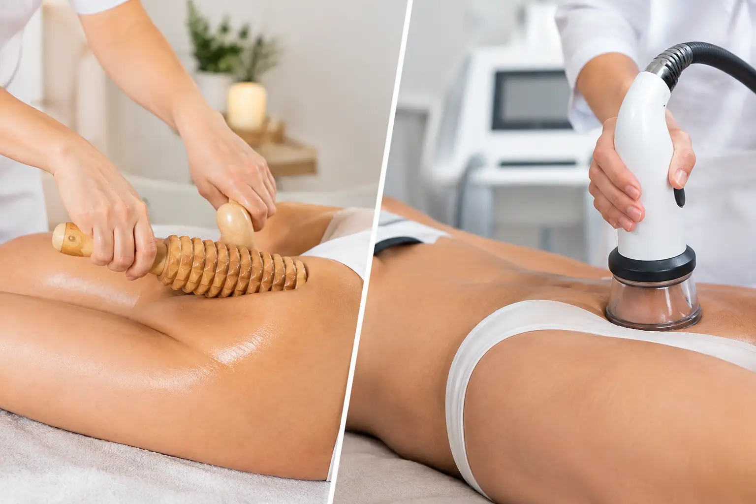 Maderoterapija ili vacuum slim – šta izabrati?
